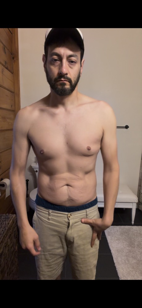Day 9 after photo